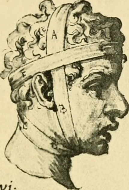 An illustration from Collection de chirurgiens grecs avec dessins attribués au Primatice. Reproduction réduite des 200 dessins du Manuscrit latin 6866 de la Bibliothèque nationale, 1908, leaf 82