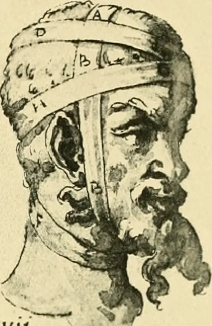 An illustration from Collection de chirurgiens grecs avec dessins attribués au Primatice. Reproduction réduite des 200 dessins du Manuscrit latin 6866 de la Bibliothèque nationale, 1908, leaf 82