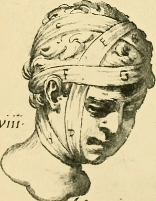 An illustration from Collection de chirurgiens grecs avec dessins attribués au Primatice. Reproduction réduite des 200 dessins du Manuscrit latin 6866 de la Bibliothèque nationale, 1908, leaf 82
