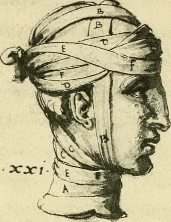 An illustration from Collection de chirurgiens grecs avec dessins attribués au Primatice. Reproduction réduite des 200 dessins du Manuscrit latin 6866 de la Bibliothèque nationale, 1908, leaf 84