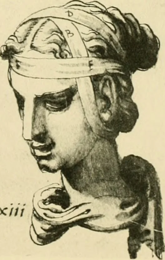 An illustration from Collection de chirurgiens grecs avec dessins attribués au Primatice. Reproduction réduite des 200 dessins du Manuscrit latin 6866 de la Bibliothèque nationale, 1908, leaf 84