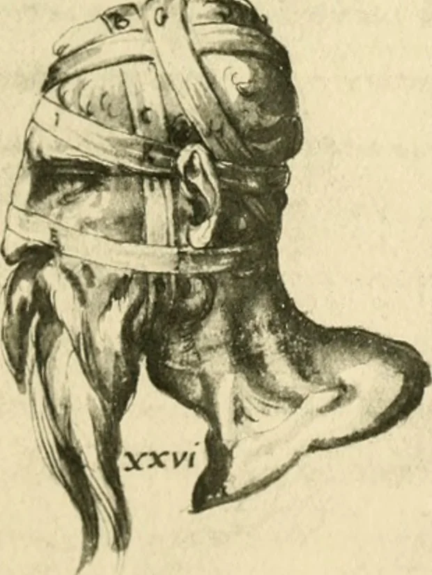 An illustration from Collection de chirurgiens grecs avec dessins attribués au Primatice. Reproduction réduite des 200 dessins du Manuscrit latin 6866 de la Bibliothèque nationale, 1908, leaf 86