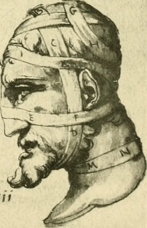 An illustration from Collection de chirurgiens grecs avec dessins attribués au Primatice. Reproduction réduite des 200 dessins du Manuscrit latin 6866 de la Bibliothèque nationale, 1908, leaf 86