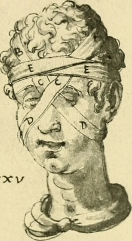An illustration from Collection de chirurgiens grecs avec dessins attribués au Primatice. Reproduction réduite des 200 dessins du Manuscrit latin 6866 de la Bibliothèque nationale, 1908, leaf 92