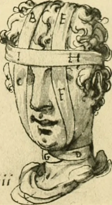An illustration from Collection de chirurgiens grecs avec dessins attribués au Primatice. Reproduction réduite des 200 dessins du Manuscrit latin 6866 de la Bibliothèque nationale, 1908, leaf 92