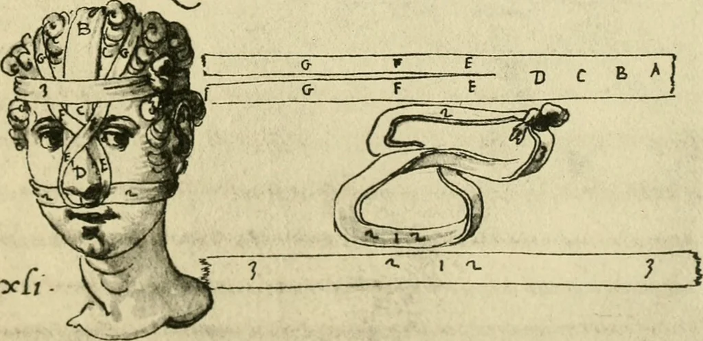 An illustration from Collection de chirurgiens grecs avec dessins attribués au Primatice. Reproduction réduite des 200 dessins du Manuscrit latin 6866 de la Bibliothèque nationale, 1908, leaf 94