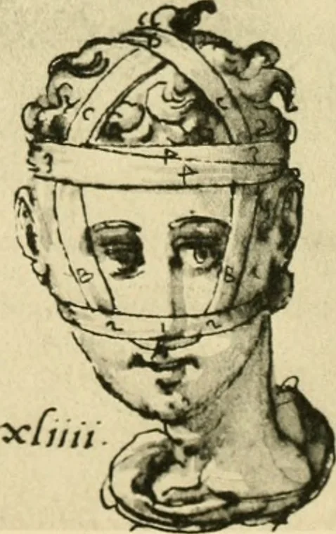 An illustration from Collection de chirurgiens grecs avec dessins attribués au Primatice. Reproduction réduite des 200 dessins du Manuscrit latin 6866 de la Bibliothèque nationale, 1908, leaf 96