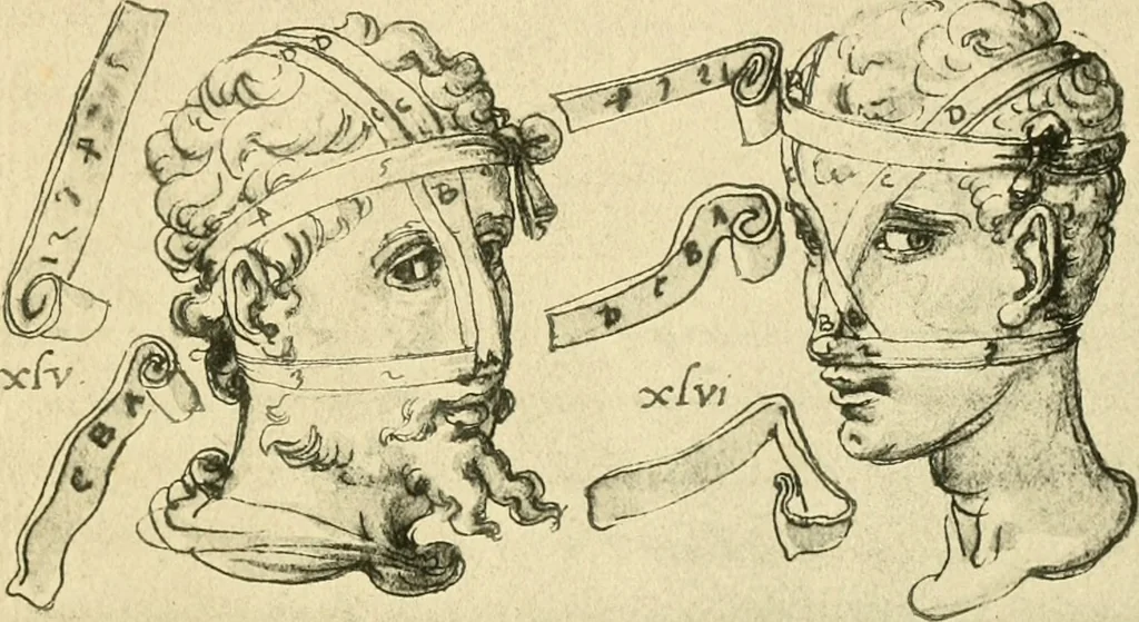 An illustration from Collection de chirurgiens grecs avec dessins attribués au Primatice. Reproduction réduite des 200 dessins du Manuscrit latin 6866 de la Bibliothèque nationale, 1908, leaf 98
