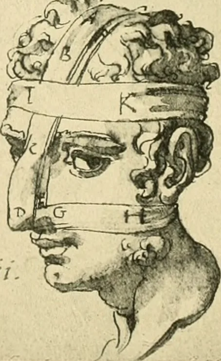 An illustration from Collection de chirurgiens grecs avec dessins attribués au Primatice. Reproduction réduite des 200 dessins du Manuscrit latin 6866 de la Bibliothèque nationale, 1908, leaf 98