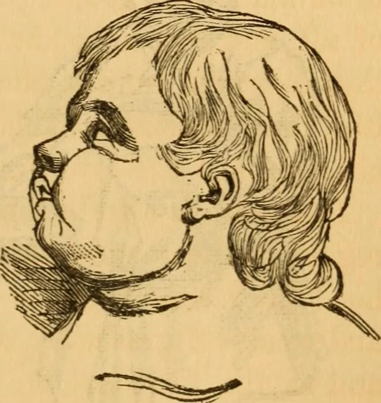 An illustration from Comparative physiognomy; or, Resemblances between men and animals, 1852, leaf 182