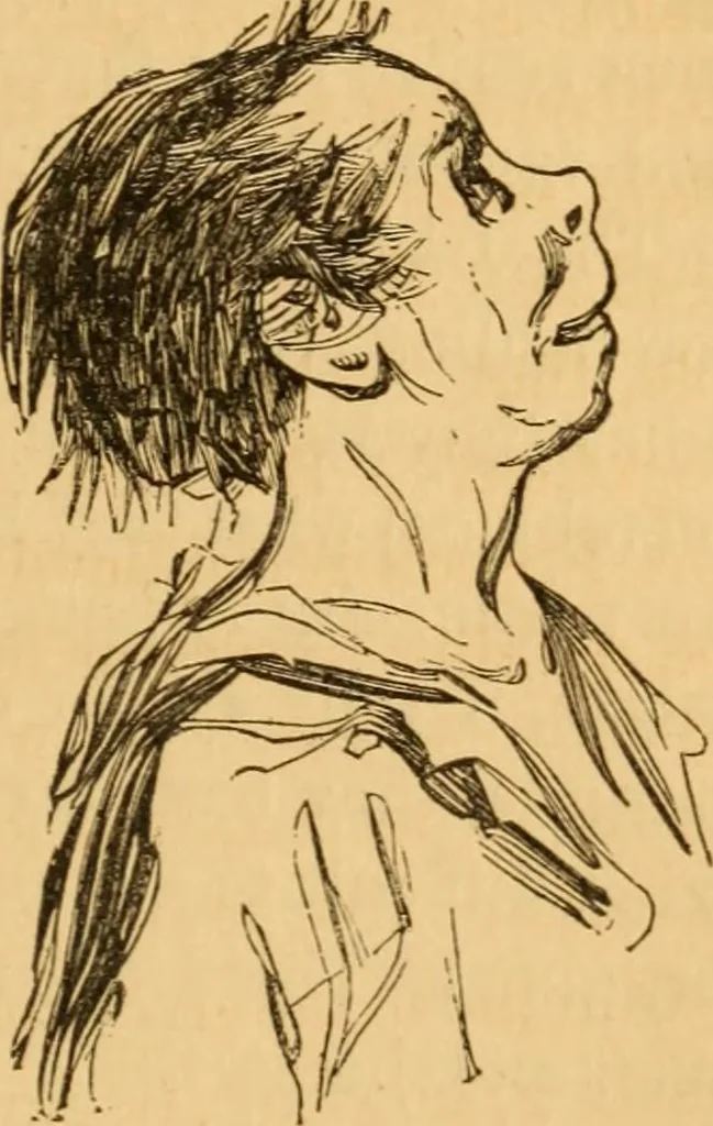 An illustration from Comparative physiognomy; or, Resemblances between men and animals, 1852, leaf 256