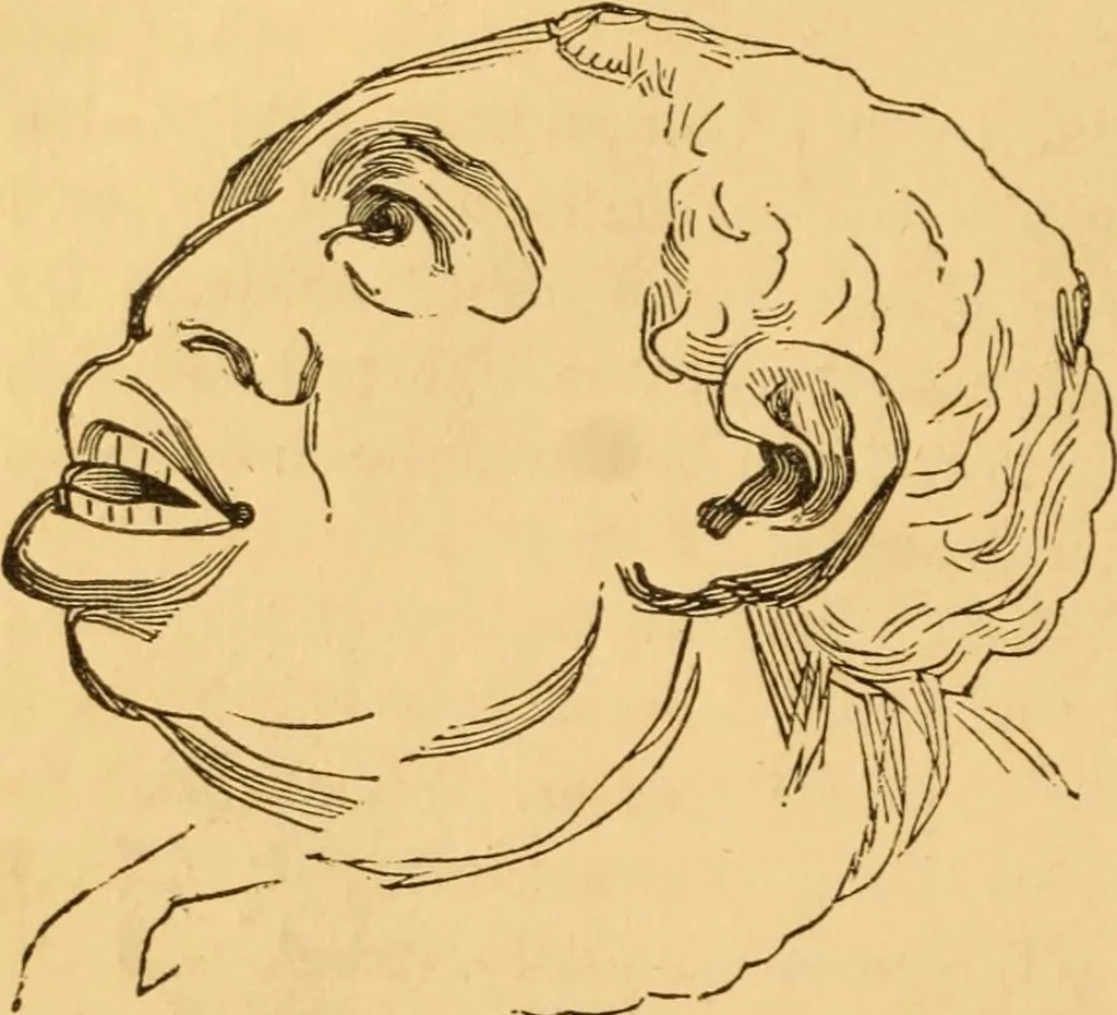 An illustration from Comparative physiognomy; or, Resemblances between men and animals, 1852, leaf 85