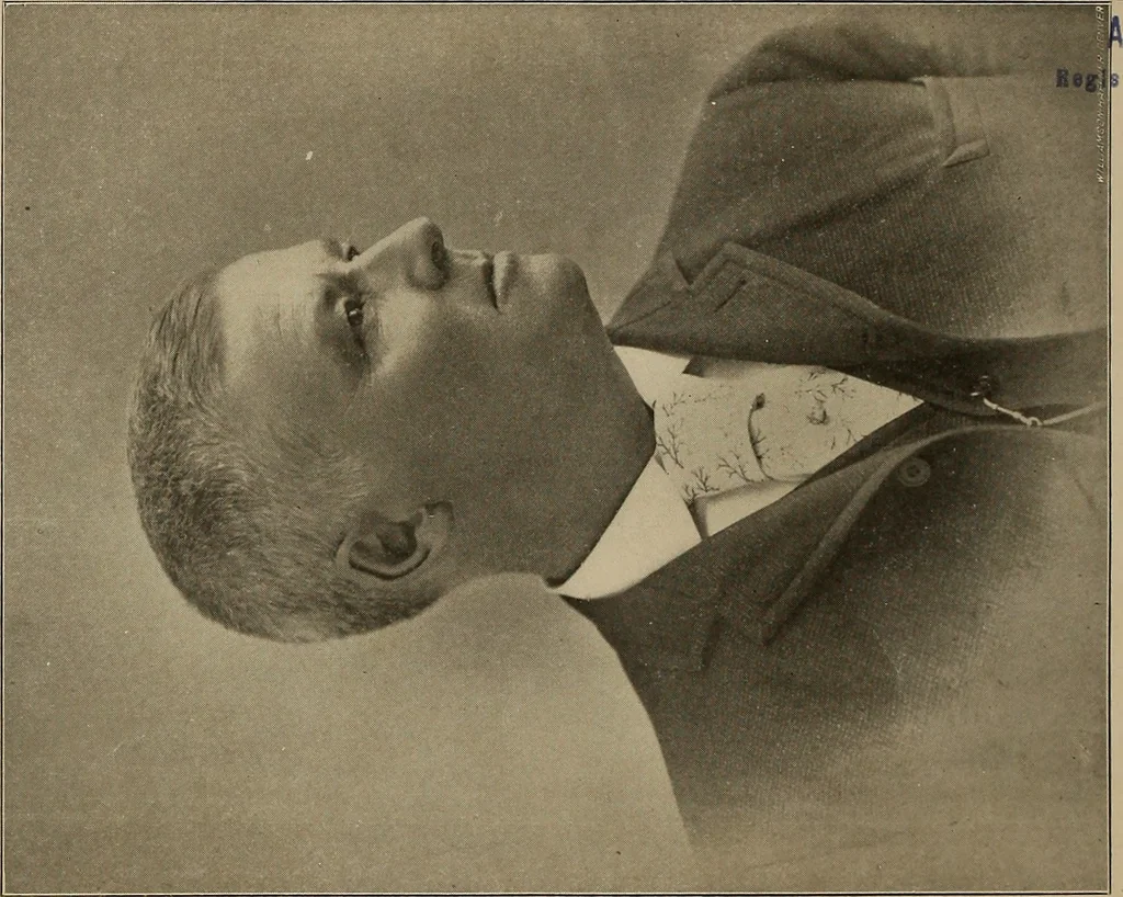 An illustration from A concise and rational course in hypnotism, 1900, leaf 7