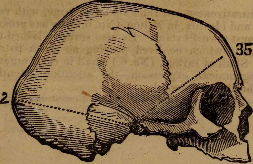 An illustration from Coombs' popular phrenology:, 1865, leaf 34