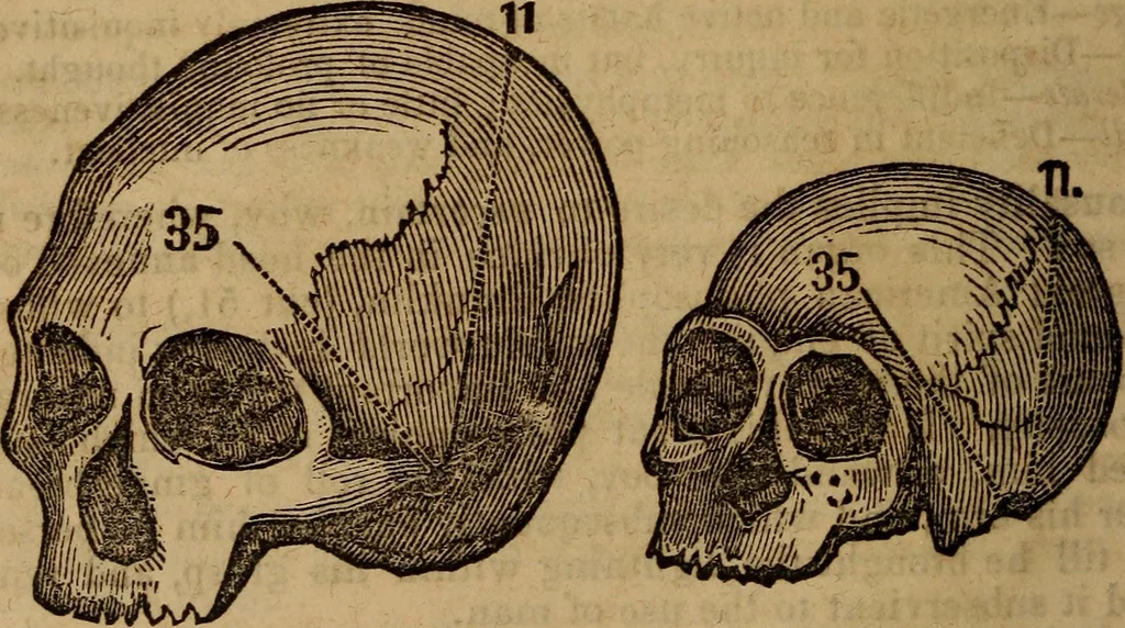 An illustration from Coombs' popular phrenology:, 1865, leaf 75