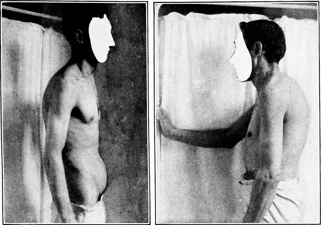 An illustration from ... Studies in vocational diseases, 1915, leaf 72