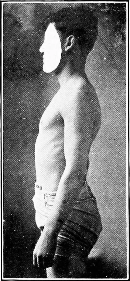 An illustration from ... Studies in vocational diseases, 1915, leaf 80