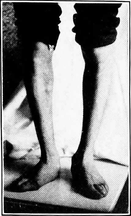 An illustration from ... Studies in vocational diseases, 1915, leaf 80