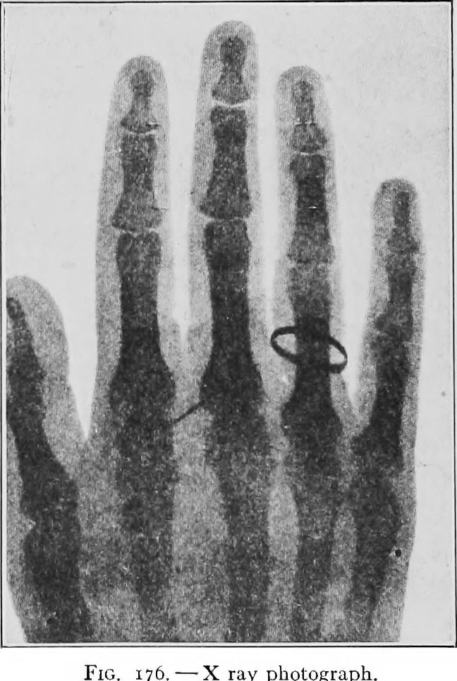 An illustration from Physics of the household, 1914, leaf 257