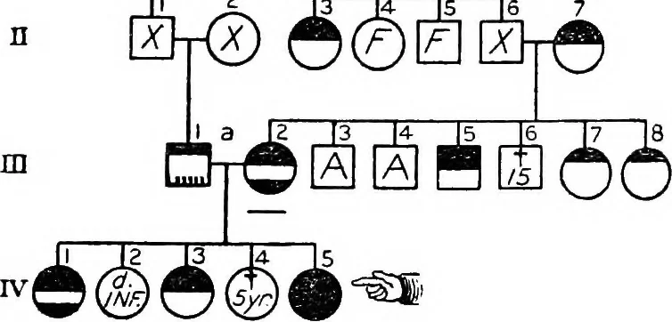 An illustration from The feebly inhibited; Nomadism, or the wandering impulse, with special reference to heredity, Inheritance of temperament, 1915, leaf 137