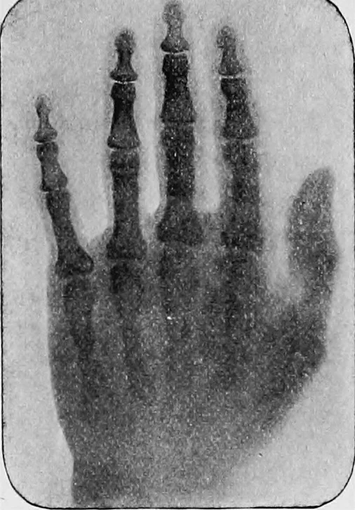 An illustration from X rays, 1918, leaf 190