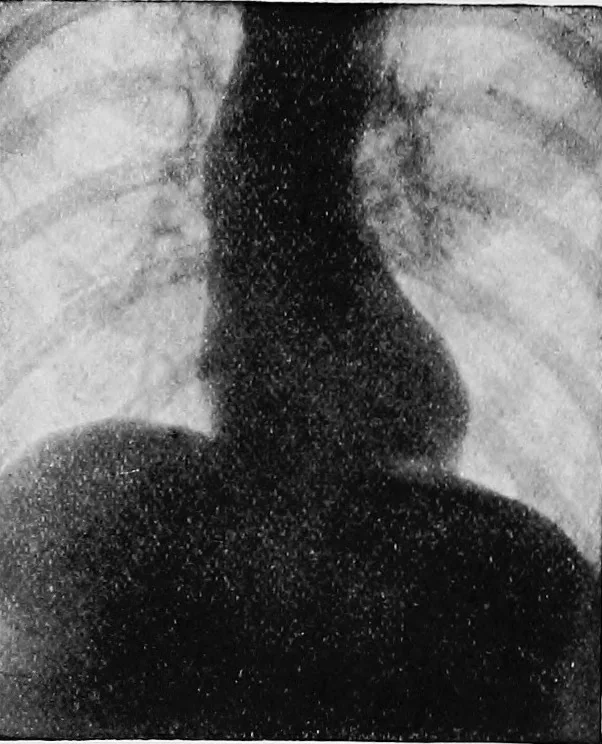 An illustration from X rays, 1918, leaf 190