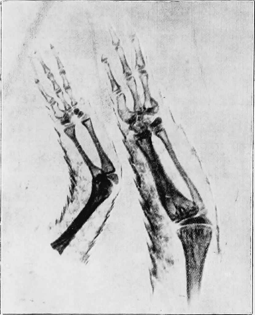 An illustration from X rays, 1918, leaf 191