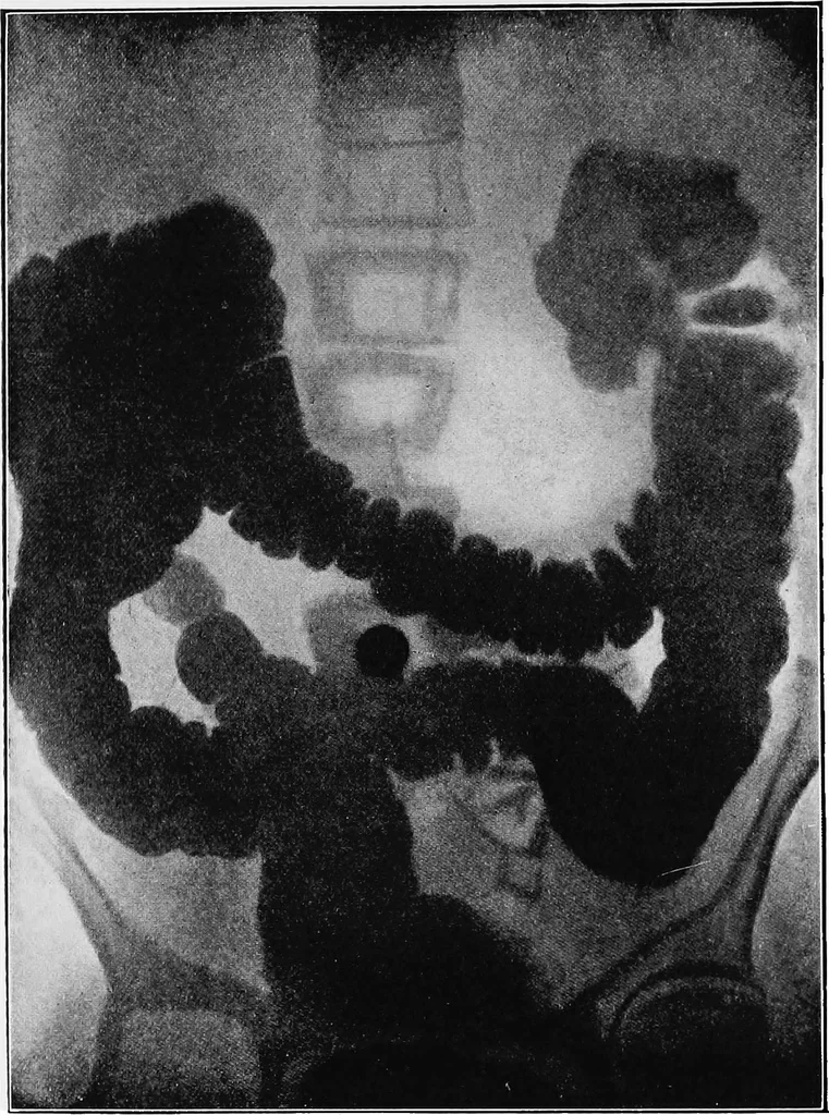 An illustration from X rays, 1918, leaf 193