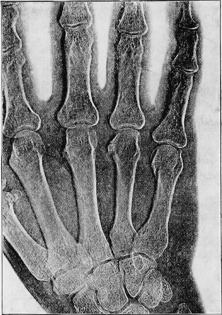 An illustration from X rays, 1918, leaf 197