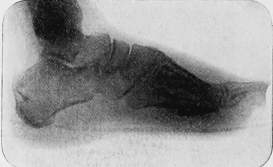 An illustration from X rays, 1918, leaf 203