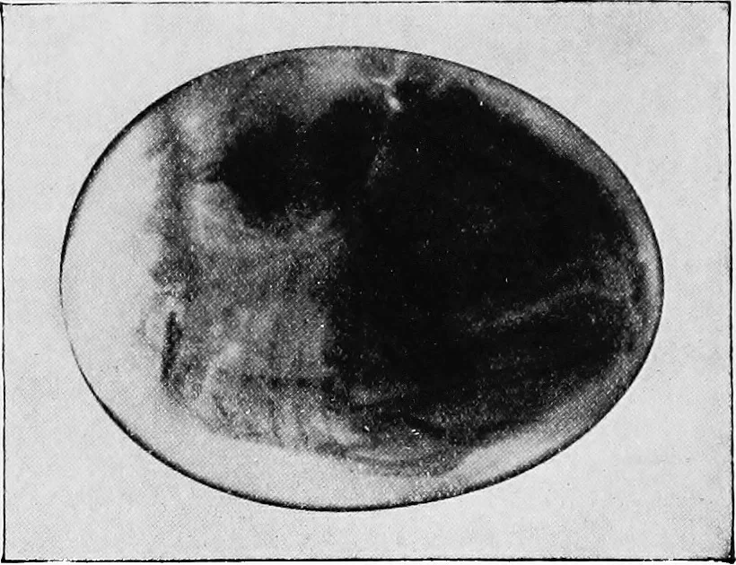 An illustration from X rays, 1918, leaf 205