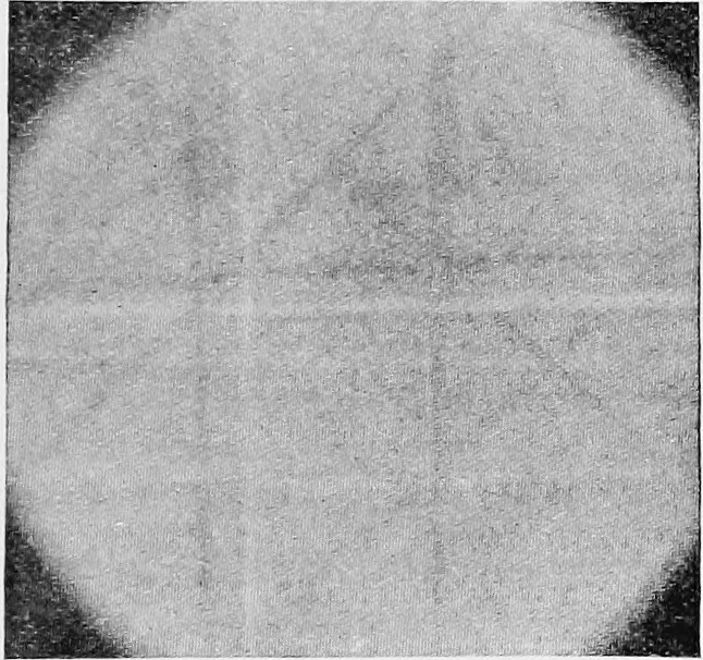 An illustration from X rays, 1918, leaf 262