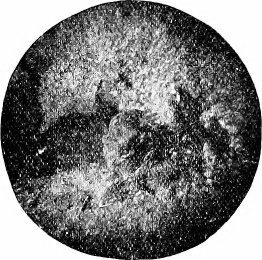 An illustration from X rays, 1918, leaf 69