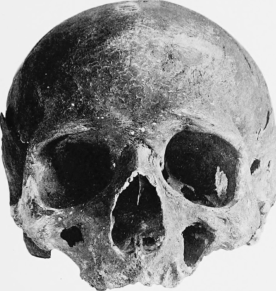 An illustration from The mortal remains of Emanuel Swedenborg; an account of the historical and anatomical investigations executed by a committee, appointed on May 27th, 1908, 1910, leaf 112