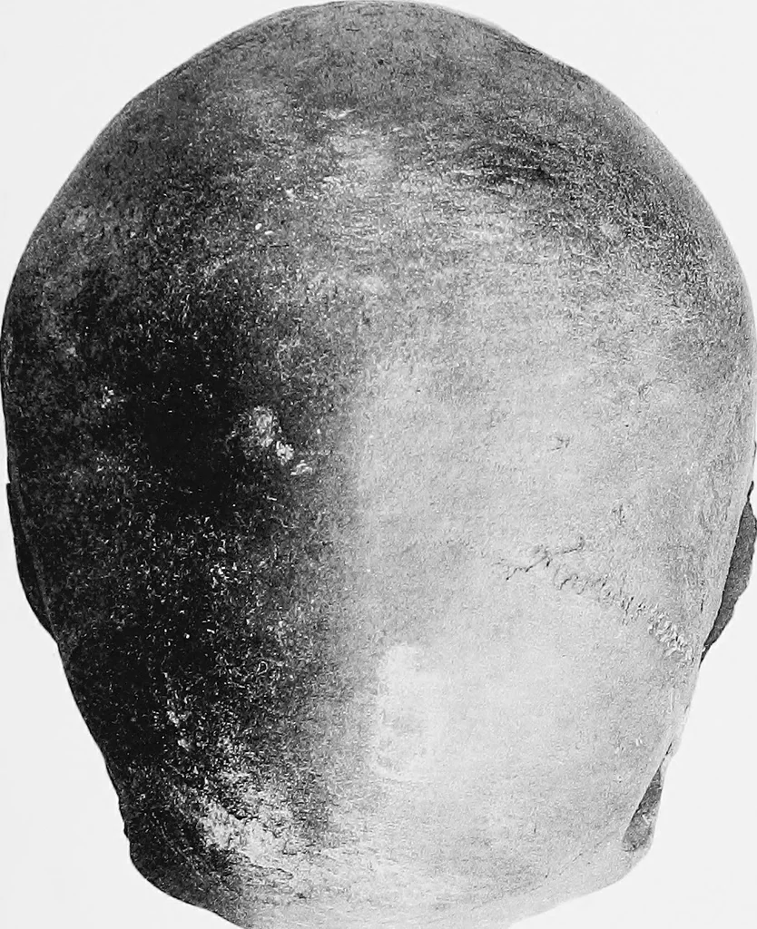 An illustration from The mortal remains of Emanuel Swedenborg; an account of the historical and anatomical investigations executed by a committee, appointed on May 27th, 1908, 1910, leaf 114