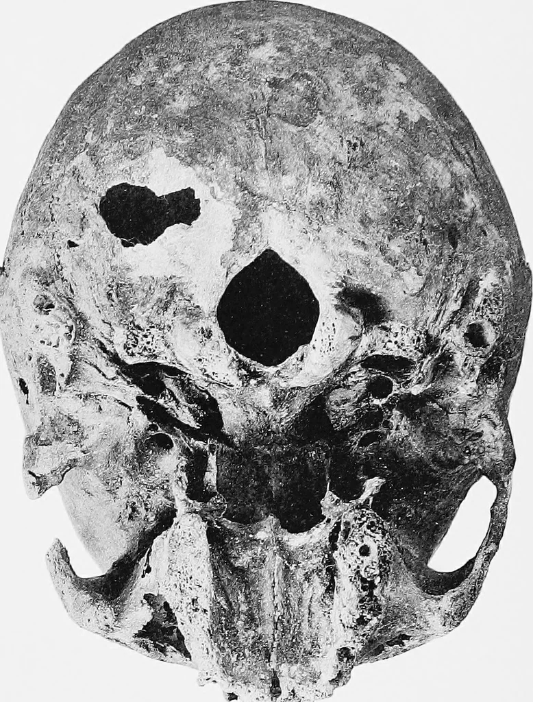 An illustration from The mortal remains of Emanuel Swedenborg; an account of the historical and anatomical investigations executed by a committee, appointed on May 27th, 1908, 1910, leaf 114