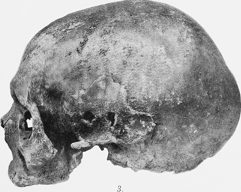 An illustration from The mortal remains of Emanuel Swedenborg; an account of the historical and anatomical investigations executed by a committee, appointed on May 27th, 1908, 1910, leaf 114