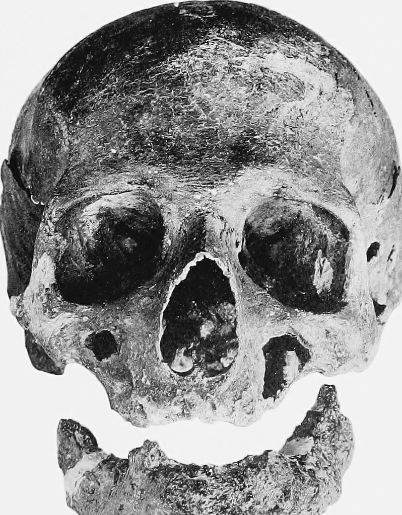 An illustration from The mortal remains of Emanuel Swedenborg; an account of the historical and anatomical investigations executed by a committee, appointed on May 27th, 1908, 1910, leaf 116