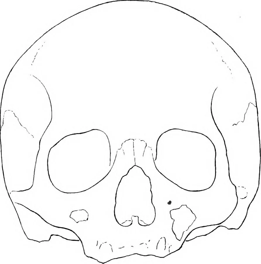 An illustration from The mortal remains of Emanuel Swedenborg; an account of the historical and anatomical investigations executed by a committee, appointed on May 27th, 1908, 1910, leaf 47