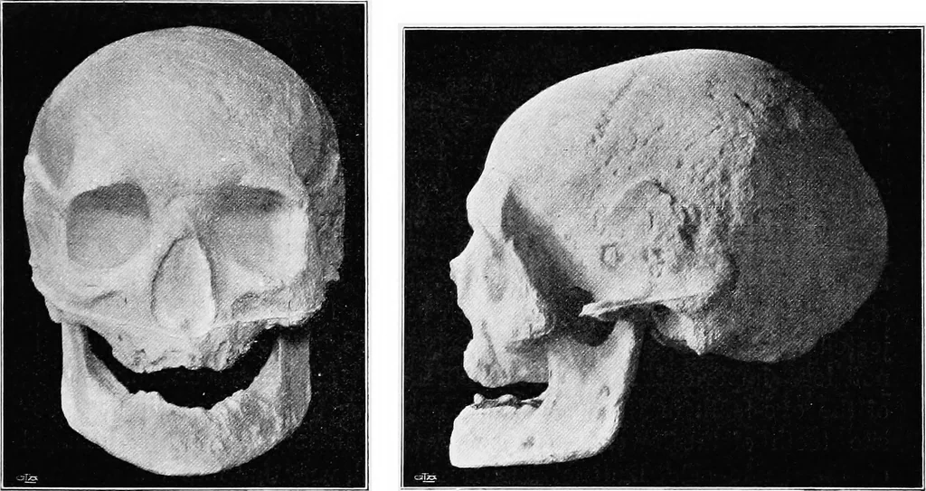 An illustration from The mortal remains of Emanuel Swedenborg; an account of the historical and anatomical investigations executed by a committee, appointed on May 27th, 1908, 1910, leaf 62