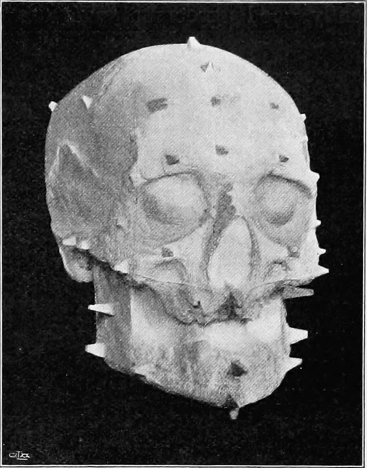 An illustration from The mortal remains of Emanuel Swedenborg; an account of the historical and anatomical investigations executed by a committee, appointed on May 27th, 1908, 1910, leaf 72