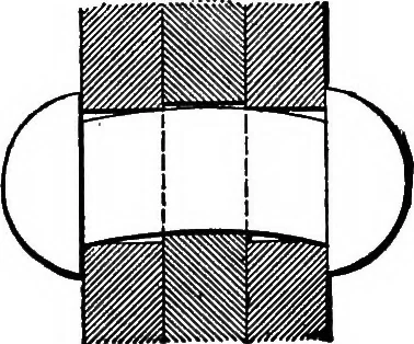 An illustration from The anatomy of bridgework, 1906, leaf 72