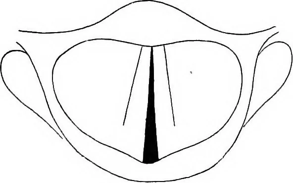An illustration from Sound : an elementary text-book for schools and colleges, 1913, leaf 172