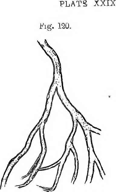 An illustration from How to work with the microscope, 1865, leaf 162