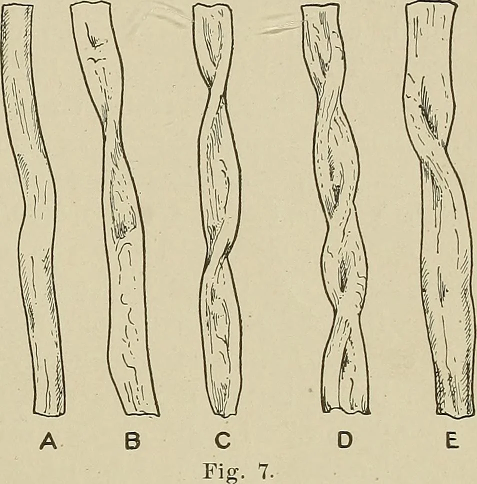 An illustration from Cyclopedia of textile work : a general reference library on cotton, woolen and worsted yarn manufacture, weaving, designing, chemistry and dyeing, finishing, knitting, and allied subjects, 1911, leaf 31