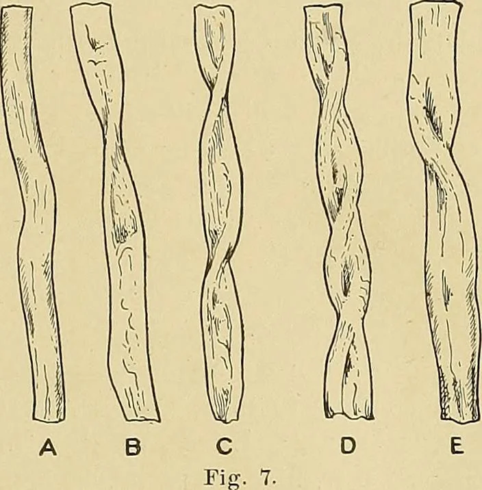 An illustration from Cyclopedia of textile work; a general reference library on cotton, woolen and worsted yarn manufacture, weaving, designing, chemistry and dyeing, finishing, knitting, and allied subjects, 1911, leaf 31