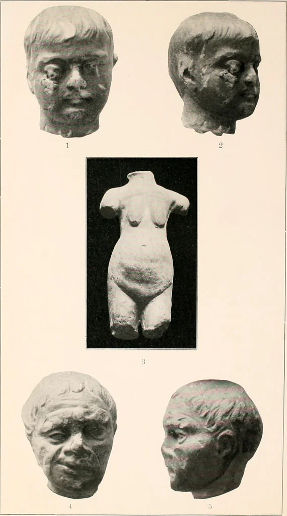 An illustration from Darstellungen normaler und krankhaft veränderter Körperteile an antiken Weihgaben, 1912, leaf 32