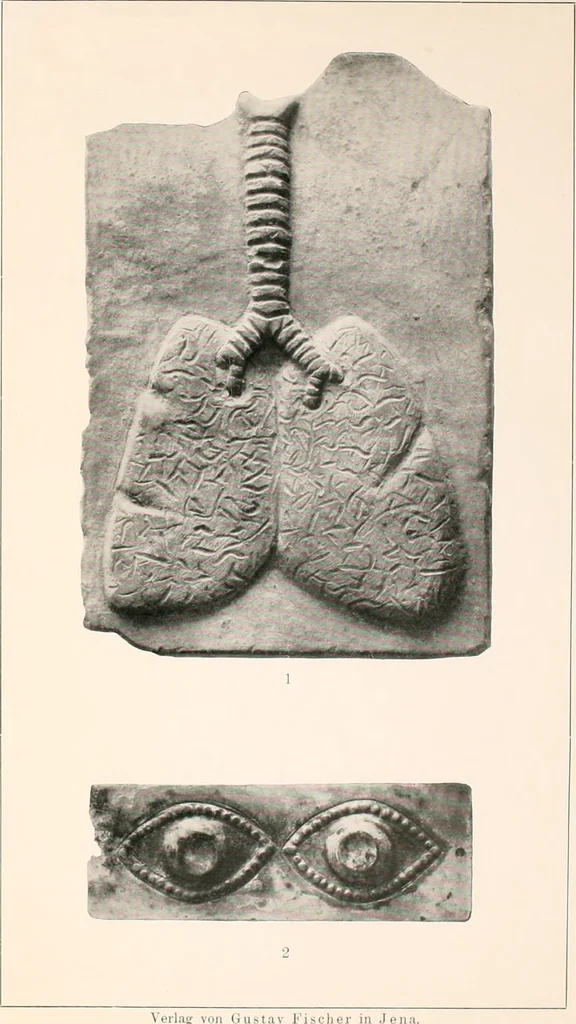 An illustration from Darstellungen normaler und krankhaft veränderter Körperteile an antiken Weihgaben, 1912, leaf 34