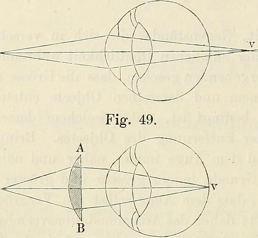 An illustration from Das mikroskop : Theorie, gebrauch, geschichte und gegenwärtiger zustand desselben, 1866, leaf 113