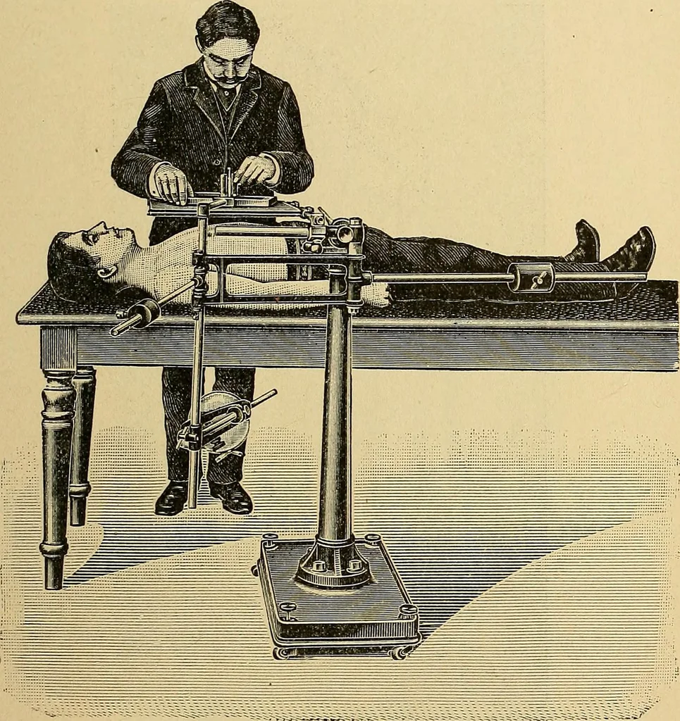 An illustration from Das Röntgen-Verfahren mit besonderer Berücksichtigung der militärischen Verhältnisse, 1903, leaf 249